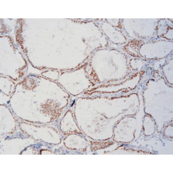 CD56, anitbody kits